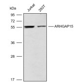 Solarbio K009905P Anti-ARHGAP15 Polyclonal Antibody