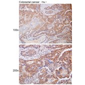 Solarbio K112215P Anti-CSNK1E Polyclonal Antibody