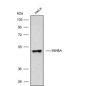 Solarbio K009902P Anti-INHBA Polyclonal Antibody