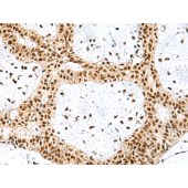 Solarbio K009859P Anti-PRPF40A Polyclonal Antibody