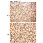Solarbio K109950P Anti-CSNK1A1 Polyclonal Antibody