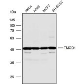 Solarbio K110030P Anti-TMOD1 Polyclonal Antibody