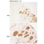 Solarbio K112188P Anti-MAGI2 Polyclonal Antibody