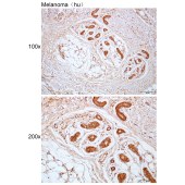 Solarbio K112424P Anti-PKLR Polyclonal Antibody