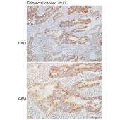 Solarbio K110313P Anti-NECAB3 Polyclonal Antibody