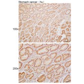 Solarbio K110015P Anti-PRKN Polyclonal Antibody