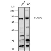 Solarbio K112210P Anti-CLASP1 Polyclonal Antibody