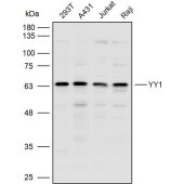 Solarbio K110334P Anti-YY1 Polyclonal Antibody