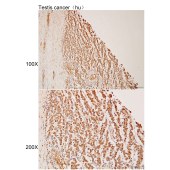 Solarbio K112169P Anti-ANKRD30A Polyclonal Antibody
