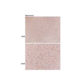 Solarbio K002046P Anti-CDH4 Polyclonal Antibody