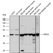 Solarbio K110102P Anti-ENO2 Polyclonal Antibody