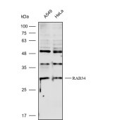 Solarbio K112260P Anti-RAB34 Polyclonal Antibody
