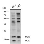 Solarbio K112214P Anti-ODF3 Polyclonal Antibody