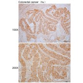 Solarbio K110314P Anti-CHST6 Polyclonal Antibody