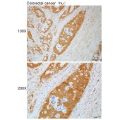 Solarbio K112241P Anti-GSR Polyclonal Antibody