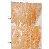 Solarbio K112180P Anti-POLR3A Polyclonal Antibody