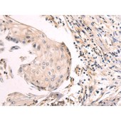 Solarbio K009816P Anti-TWSG1 Polyclonal Antibody