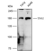 Solarbio K112174P Anti-TNS2 Polyclonal Antibody