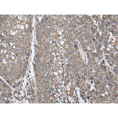 Solarbio K009823P Anti-ATAD1 Polyclonal Antibody