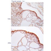 Solarbio K112278P Anti-TMEM71 Polyclonal Antibody