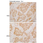 Solarbio K110074P Anti-FAM149B1 Polyclonal Antibody