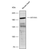 Solarbio K112197P Anti-MYOM1 Polyclonal Antibody