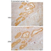 Solarbio K110115P Anti-KEAP1 Polyclonal Antibody