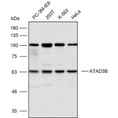 Solarbio K112426P Anti-ATAD3B Polyclonal Antibody