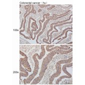 Solarbio K110503P Anti-SQLE Polyclonal Antibody