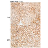 Solarbio K109959P Anti-KRT8 Polyclonal Antibody