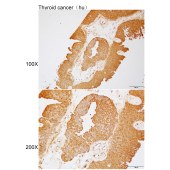 Solarbio K112175P Anti-COL18A1 Polyclonal Antibody
