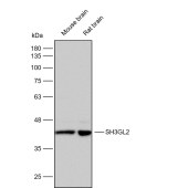 Solarbio K112253P Anti-SH3GL2 Polyclonal Antibody