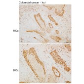 Solarbio K110078P Anti-STXBP1 Polyclonal Antibody