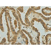 Solarbio K009809P Anti-UGT2B4 Polyclonal Antibody