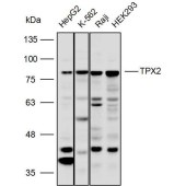 Solarbio K110381P Anti-TPX2 Polyclonal Antibody