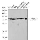 Solarbio K009847P Anti-THNSL1 Polyclonal Antibody