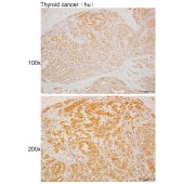 Solarbio K110487P Anti-NTAQ1 Polyclonal Antibody