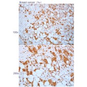 Solarbio K112283P Anti-PIH1D1 Polyclonal Antibody