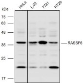 Solarbio K110308P Anti-RASSF6 Polyclonal Antibody