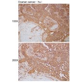 Solarbio K112219P Anti-ATG2B Polyclonal Antibody