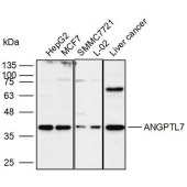 Solarbio K110005P Anti-ANGPTL7 Polyclonal Antibody