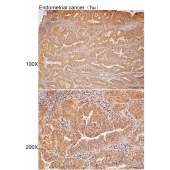 Solarbio K112164P Anti-PRAG1 Polyclonal Antibody