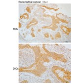 Solarbio K110008P Anti-CCDC112 Polyclonal Antibody