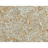 Solarbio K009904P Anti-SEMA3G Polyclonal Antibody