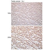 Solarbio K112319P Anti-PAAF1 Polyclonal Antibody
