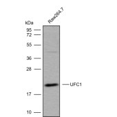 Solarbio K009822P Anti-UFC1 Polyclonal Antibody
