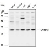 Solarbio K110081P Anti-CYB5R1 Polyclonal Antibody