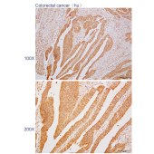 Solarbio K110457P Anti-FGR Polyclonal Antibody