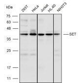 Solarbio K110517P Anti-SET Polyclonal Antibody