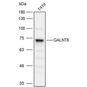 Solarbio K110069P Anti-GALNT6 Polyclonal Antibody